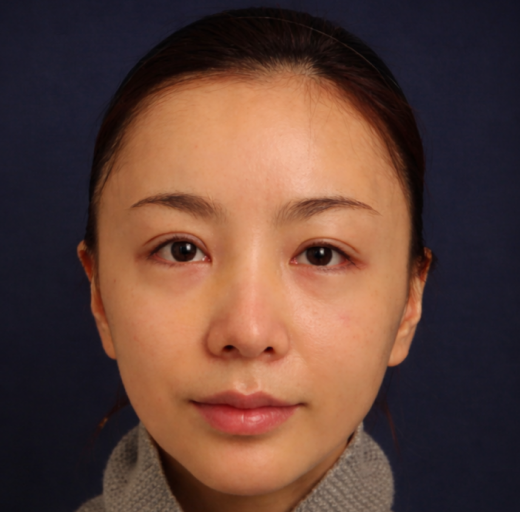 Before/After Image